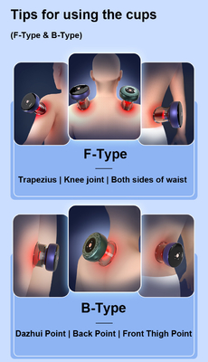 OEM/ODM Body Fitdash F-Type Cupping Cups για εξατομικευμένο μασάζ θεραπείας χιτζάμα
