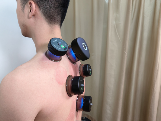 Fitdash έξυπνη μασάζ Cupping κενό Cupping θεραπευτική μηχανή σετ με έλεγχο κουμπιού