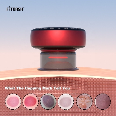 Επαναστατήστε τη ρουτίνα μασάζ σας με το Fitdash Rhythmic Cupping Massage Smart Cupping