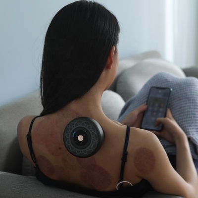 Ελέγχου κουμπιών Fitdash Smart Cupping Therapy Set για την κατάθλιψη της μέσης και της αντικυτταρίτιδας
