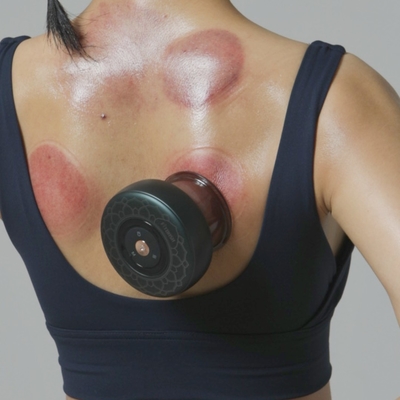 Ασύρματο Fitdash Smart Moxibustion Μασάζ με υπέρυθρη θερμότητα