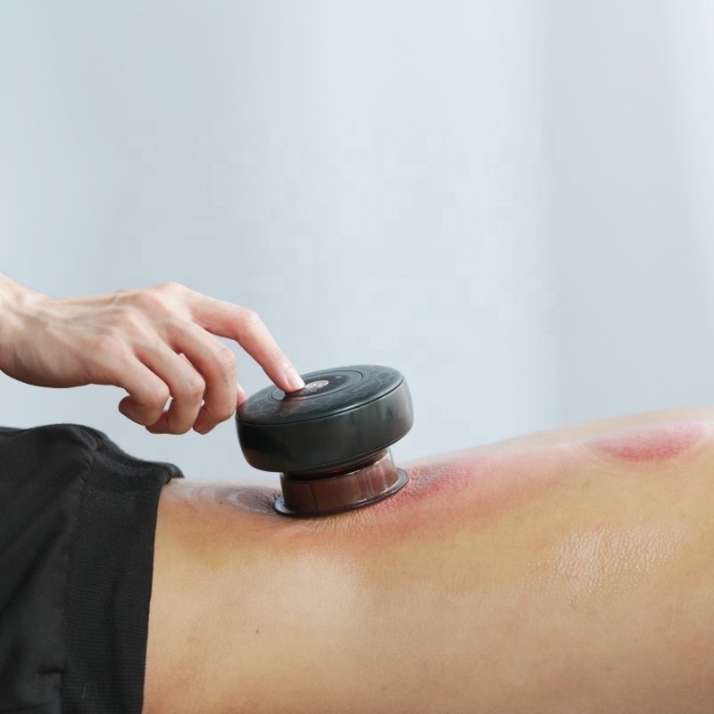Fitdash Gua Sha Μασάζ Κούπα για αποτελεσματική ανακούφιση από τον πόνο Χρόνος φόρτισης Περίπου 4 ώρες