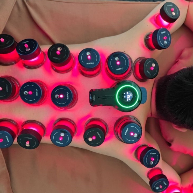 Ενίσχυρη μηχανή Fitdash Vacuum Cupping Therapy 650nm Κόκκινο Φως για ανακούφιση από τον πόνο του σώματος